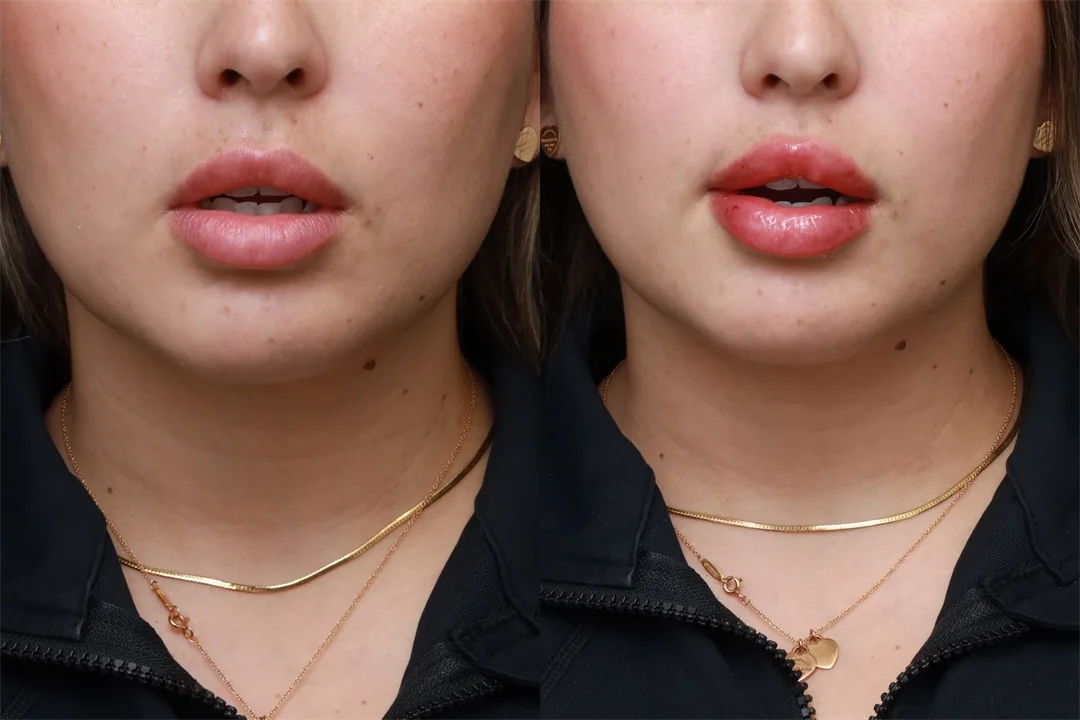 86324-AP Lips Parted combined