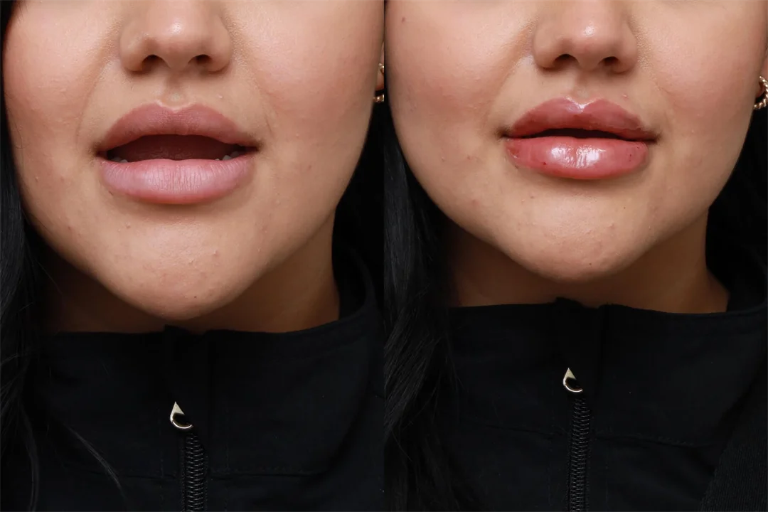 86325-AP Lips Parted combined