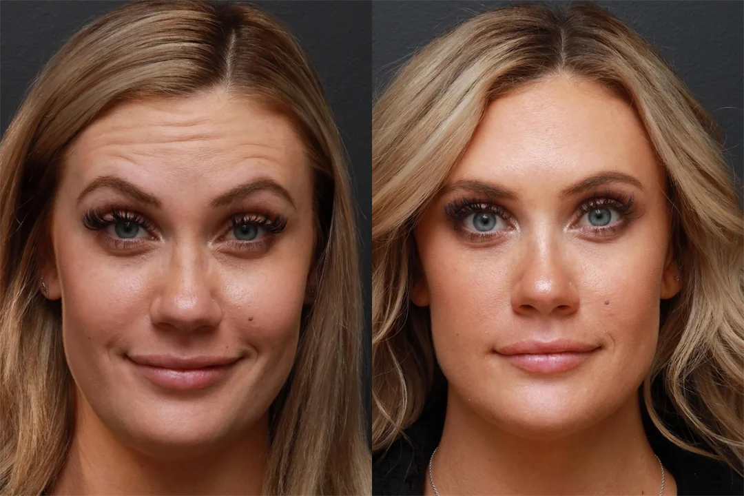 86836-AP Eyebrows Raised combined