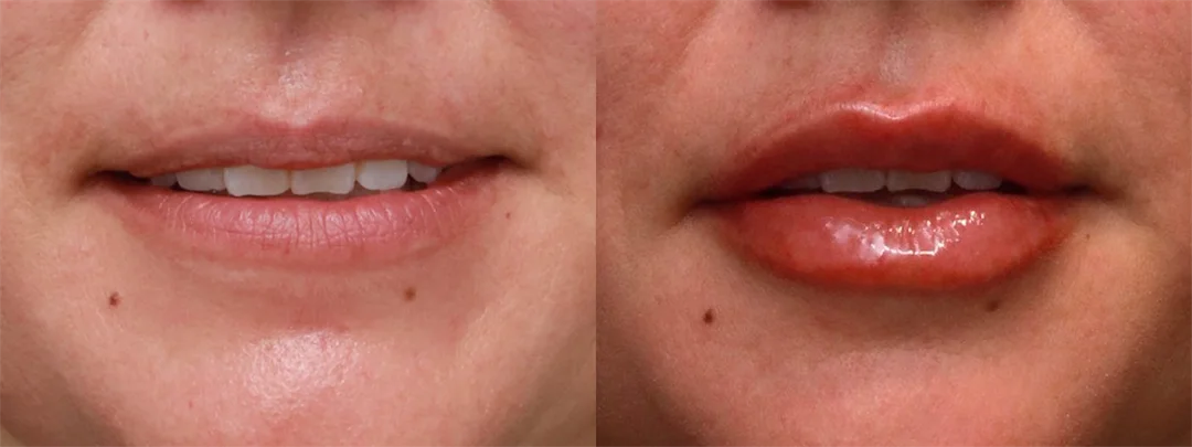 88025-AP Lips Parted combined