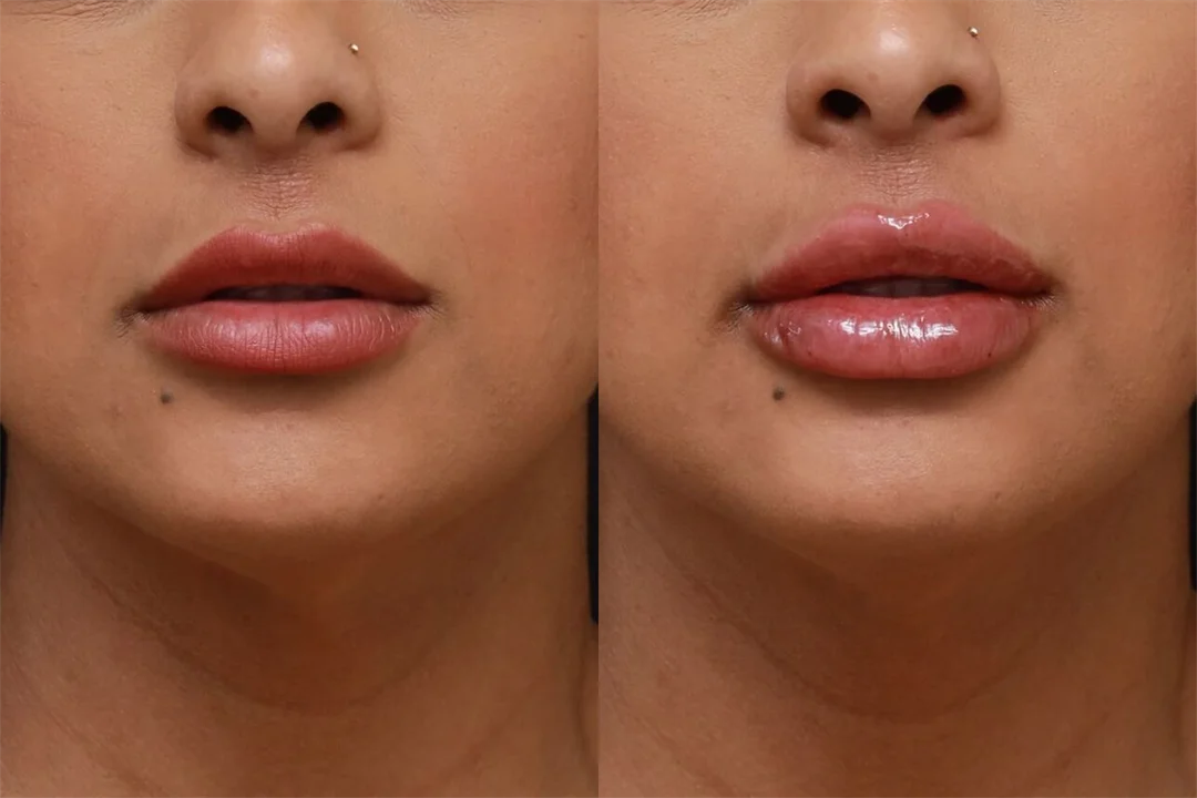 90111-AP Lips Parted combined