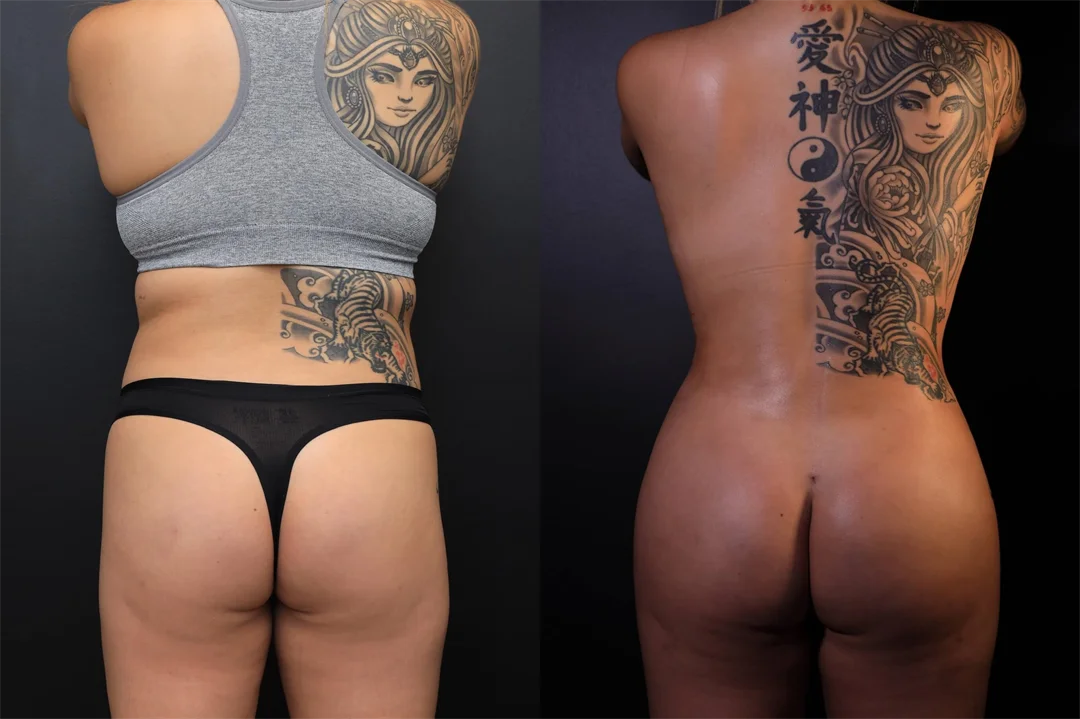 95518-Posterior combined