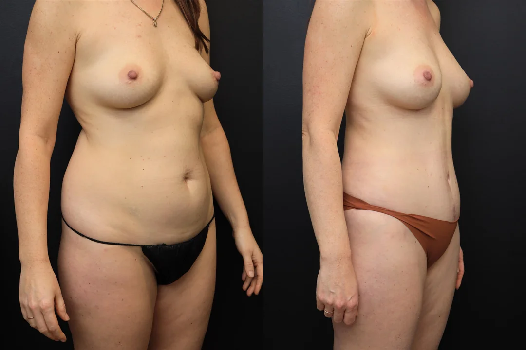 98048-Right Oblique combined
