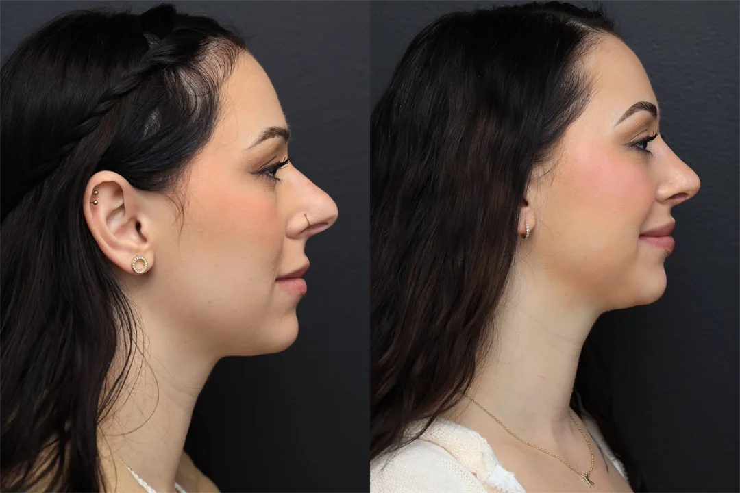 98509-Right Lateral combined